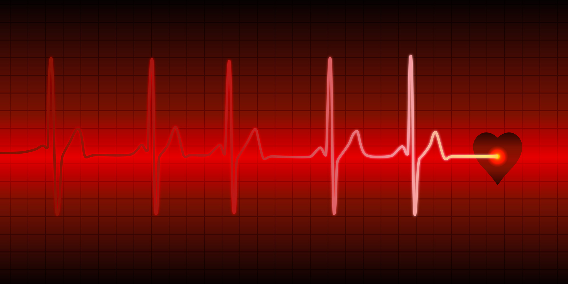 Palpitations cardiaques : quand faut-il s'inquiéter